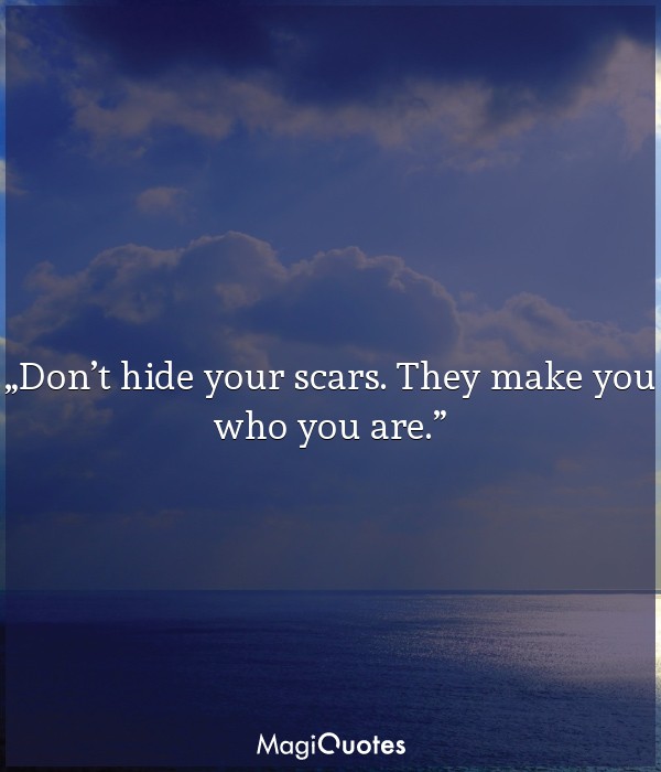 Don’t hide your scars. They make you who you are
